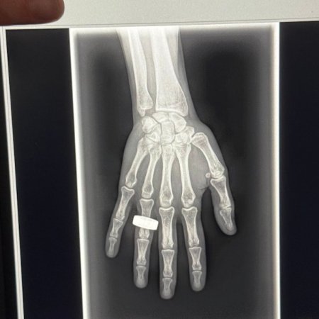 First X-ray taken in space